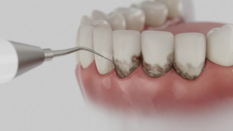 Trusted Root Canal Treatment service in Brecksville, OH - Dentist Open Now